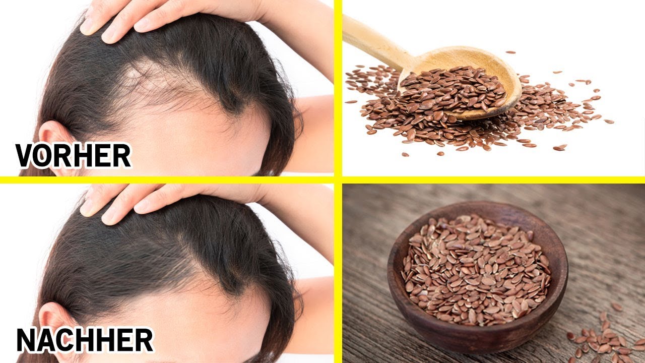 Schau, wie Leinsamen das Haarwachstum positiv beeinflussen!