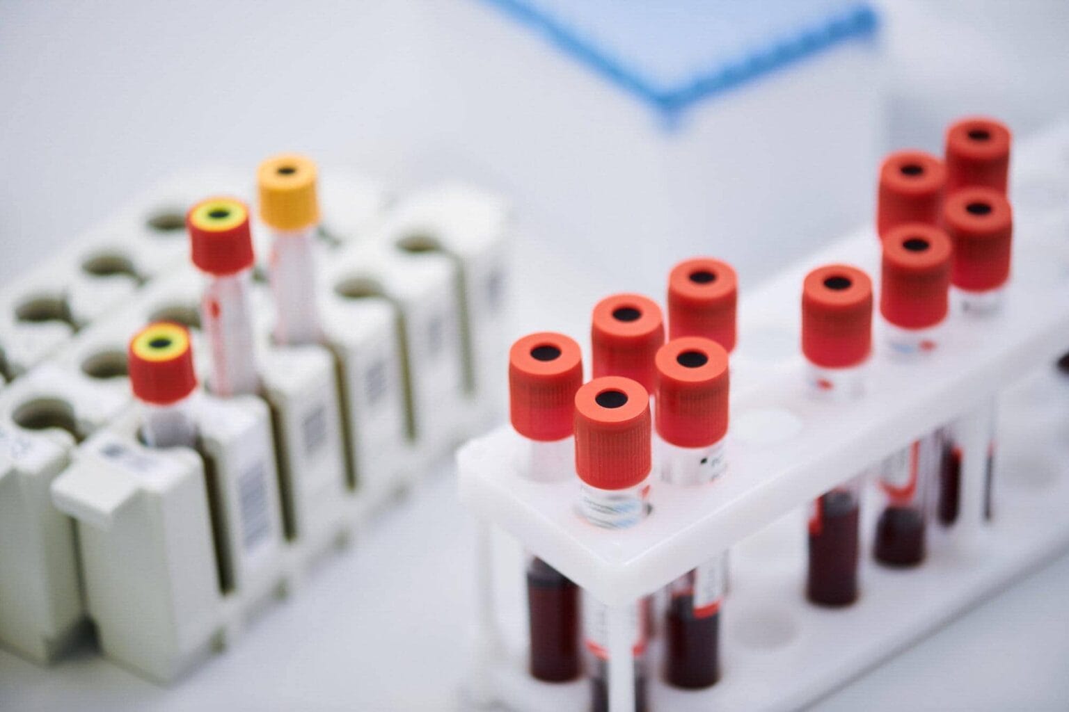 Ist CBD beim Drogentest nachweisbar? Gesundheitszentrale
