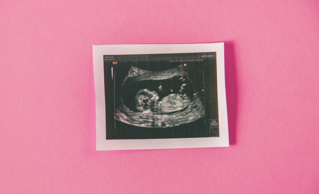 Ein Gesetz in Texas ein Embryo hat kein Herz